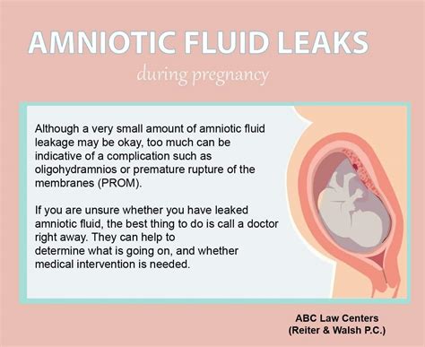 how to tell if leaking amniotic fluid|Water Breaking: What Are the Signs of Leaking。